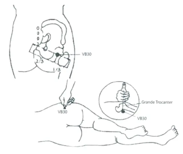 Pontos-Vesicula-Biliar-b.webp