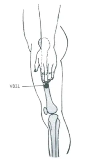 Pontos-Vesicula-Biliar-d.webp
