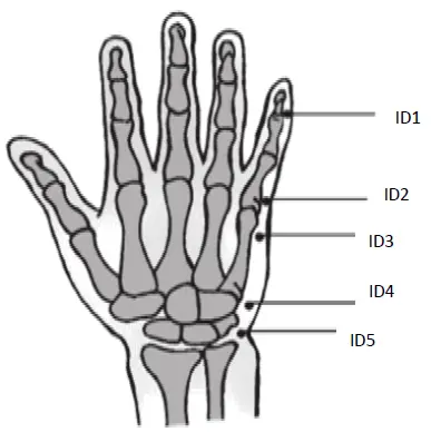pontos-idelgado-a.webp