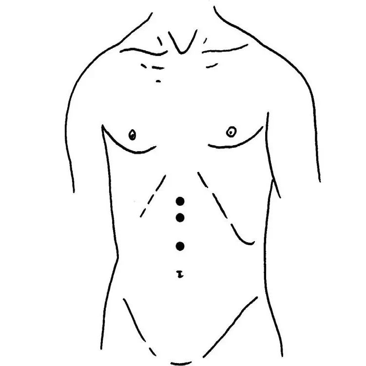 trinca abdominal Ibrate.webp