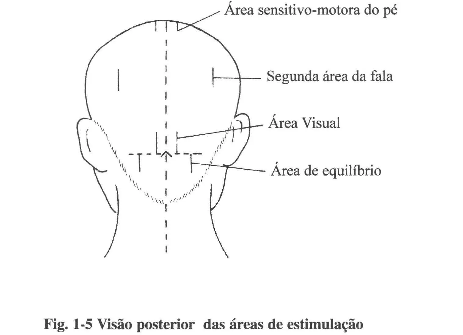 Shunfa 2006 1-5 vista posterior.webp